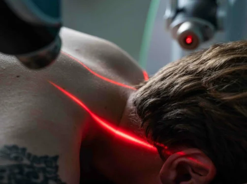 laserbehandling-stockholm-bromma